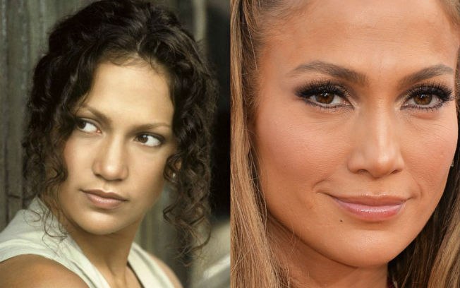 A cantora e atriz Jennifer Lopez também está na lista das famosas que já fizeram a bichectomia